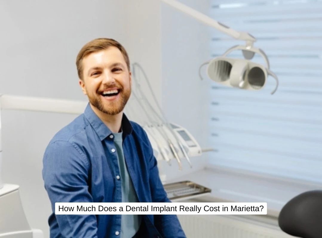 How Much Does a Dental Implant Really Cost in Marietta?