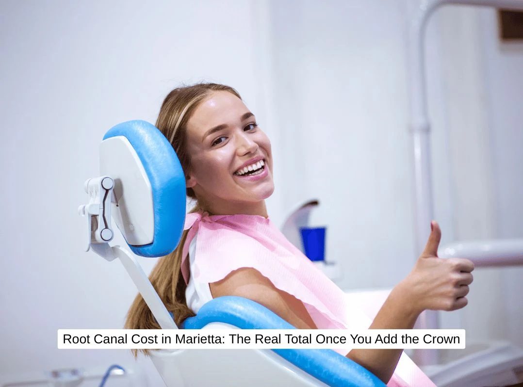 Root Canal Cost in Marietta: The Real Total Once You Add the Crown 1 Root Canal Cost in Marietta: The Real Total Once You Add the Crown